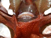 Spermathek einer B.albopilosum Detailansicht